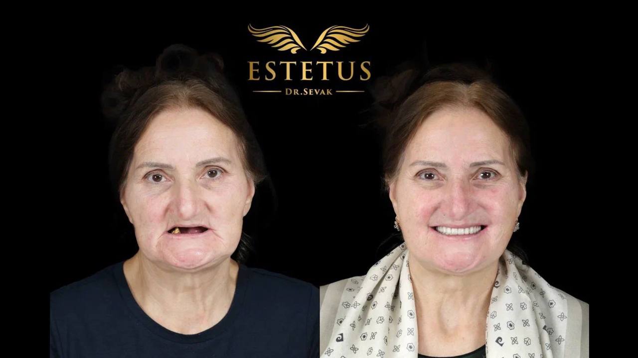 Клиника доктора Севака Estetus