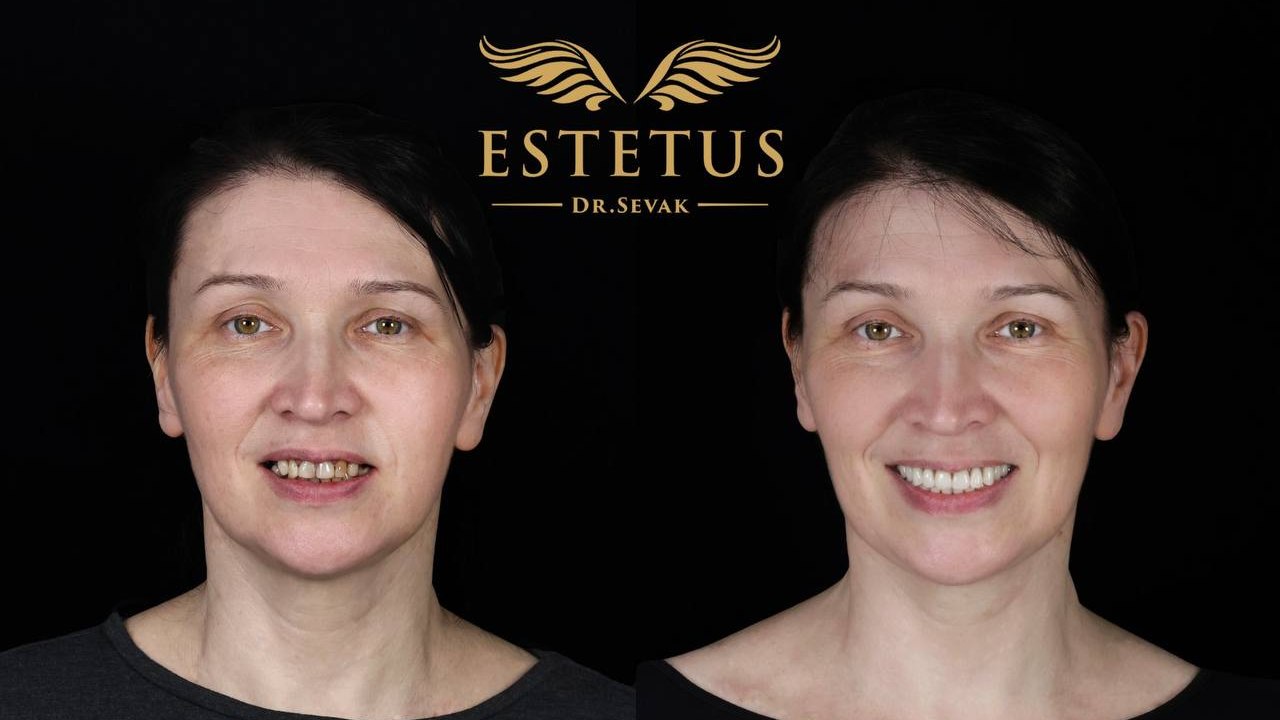 Клиника доктора Севака Estetus
